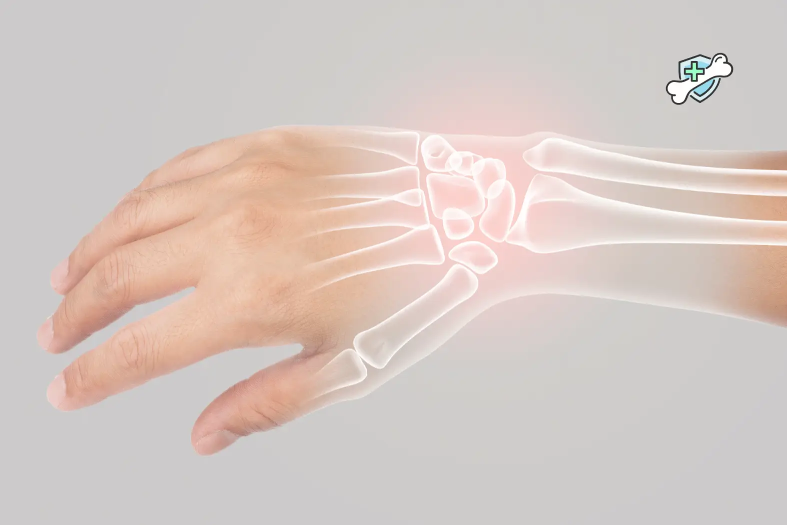 Nutrition Tips for Stronger Bones